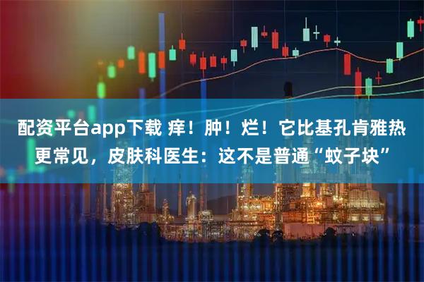 配资平台app下载 痒！肿！烂！它比基孔肯雅热更常见，皮肤科医生：这不是普通“蚊子块”